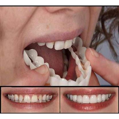 Foto de Silicone Natural False Tooth Kit