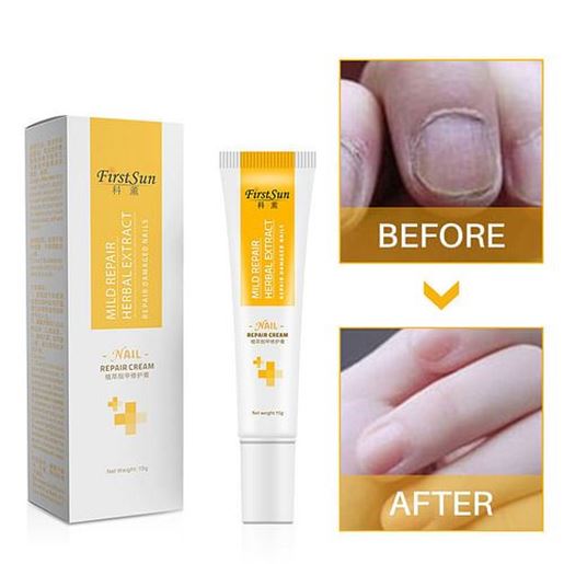 Foto de Nail Repair Cream